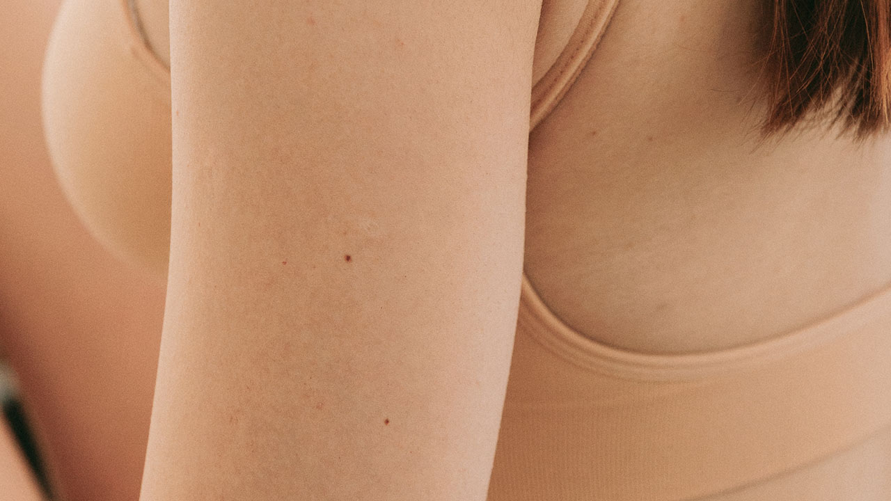 Back of arms